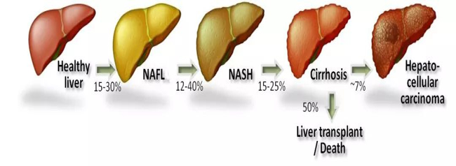 肝癌形成過程