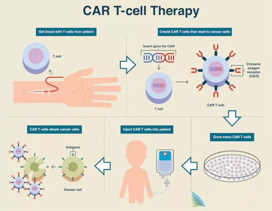 CAR-T細胞療法