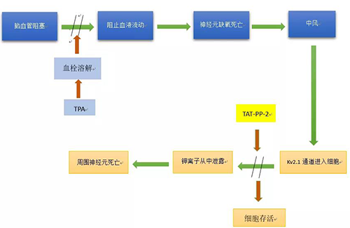 腦卒中形成機製