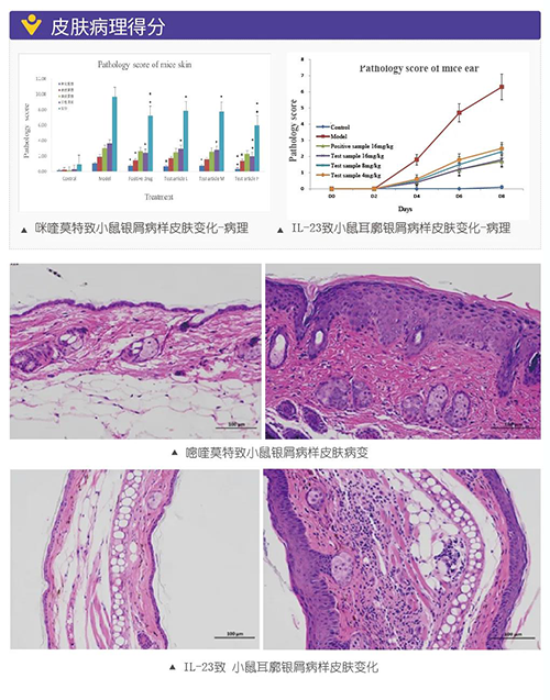 咪喹莫特致小鼠銀屑病樣皮膚變化病理得分