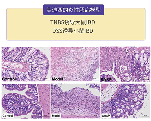 hjc黄金城的炎症性腸病模型