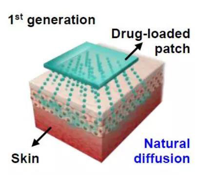 第一代透皮給藥技術：通過藥物的自然擴散.jpg