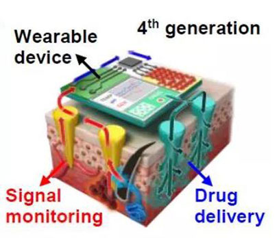 第四代透皮給藥技術：在可穿戴設備的幫助下，用於患者定製治療.jpg