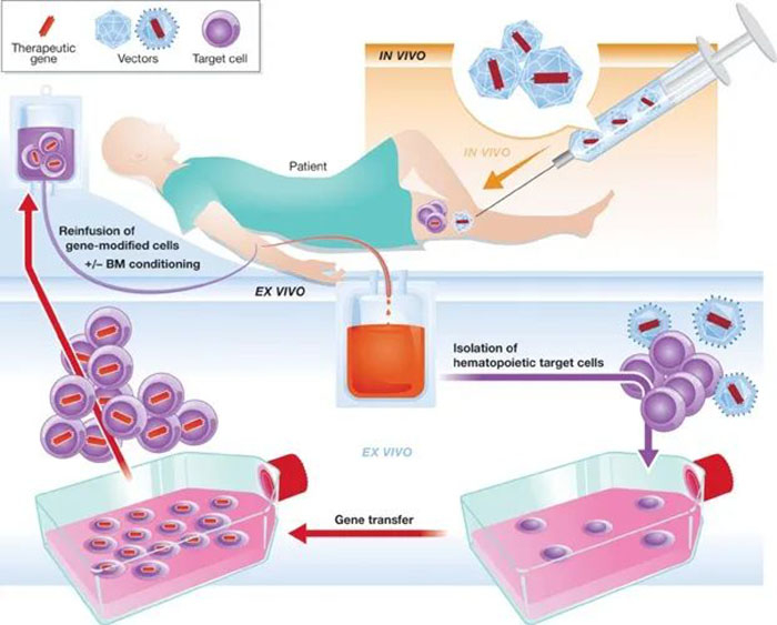 體內和離體基因治療.jpg