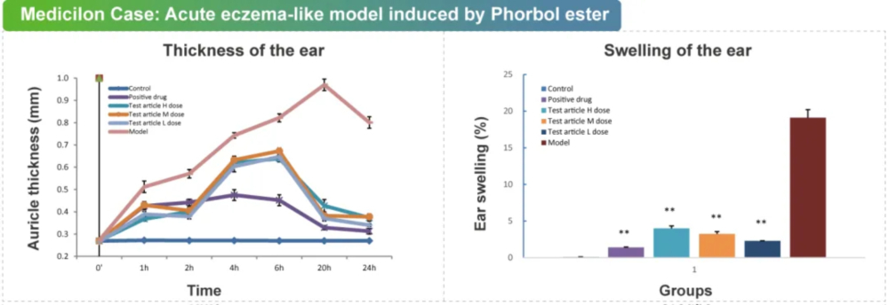 07 佛波酯誘導的急性濕疹樣模型.jpg