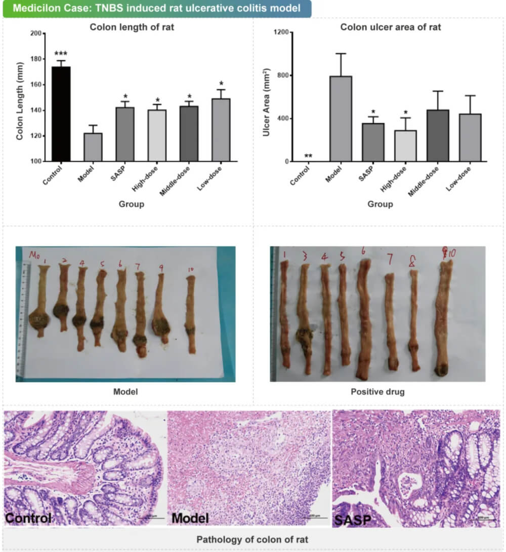 10 TNBS誘導的大鼠潰瘍性結腸炎模型.jpg